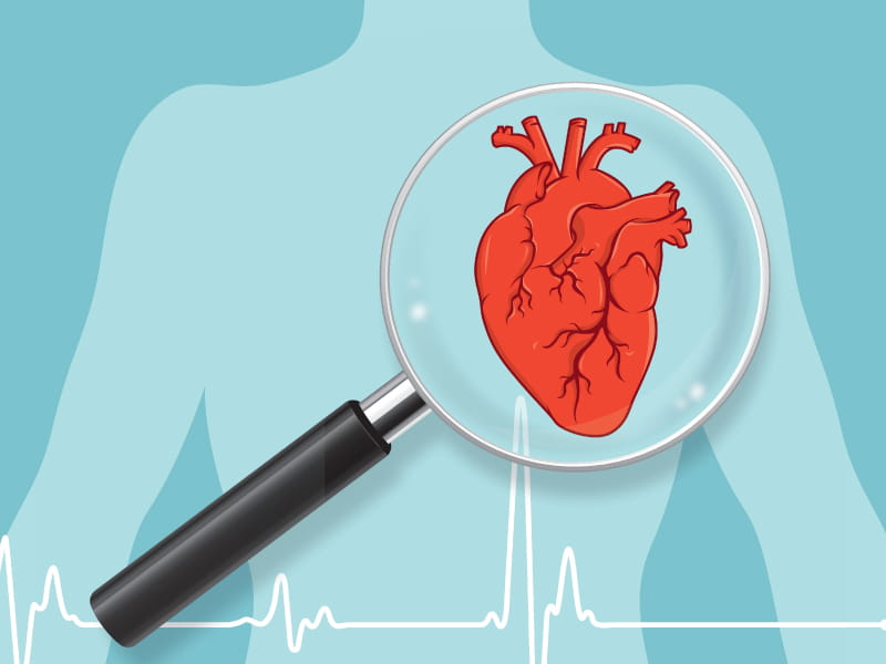 ‼️ Diagnosticul de infarct miocardic‼️la DR ALJOBORY CLINIC Caransebes